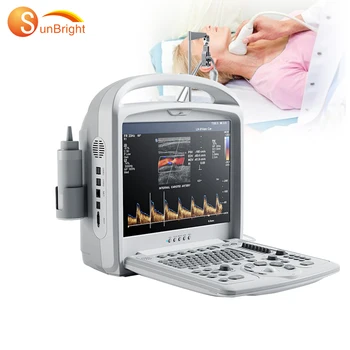 barvni doppler CE digitalni prenosni barvni doppler ultrazvok medicinske opreme/poceni doppler ultrazvok stroj, skener cena